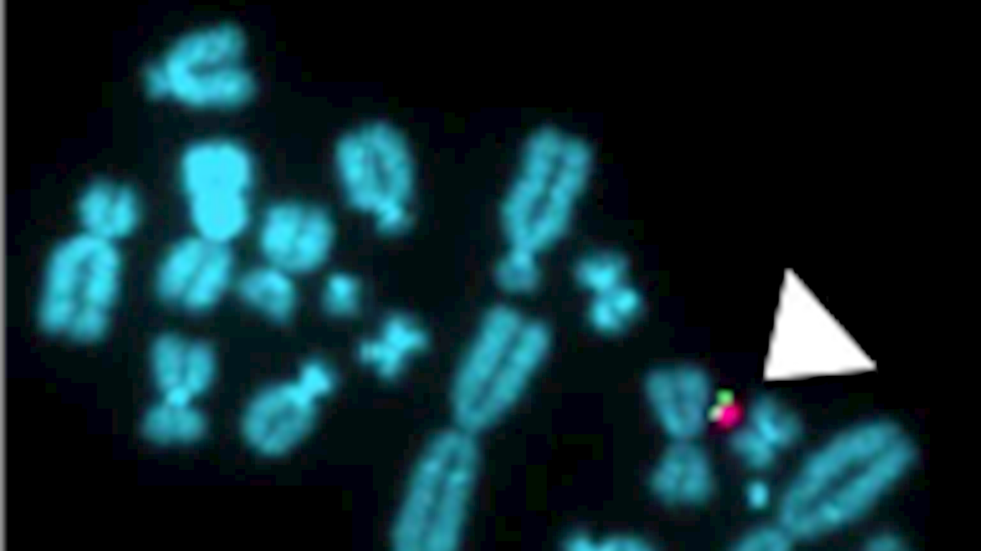 Microscopic chromosome